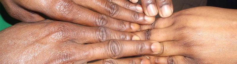 Four hands touching.