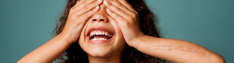 A laughing child, with a scar across her left forearm, covers her eyes.
