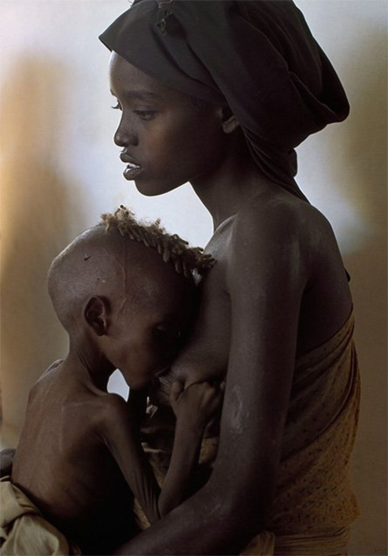 A woman breastfeeds a painfully thin baby.