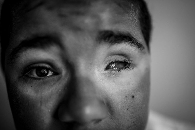 Andrew Renneisen, the 2016 recipient of the Ian Parry Award for Achievement, documented the practice of “witch” lynchings in towns along Kenya’s coast.