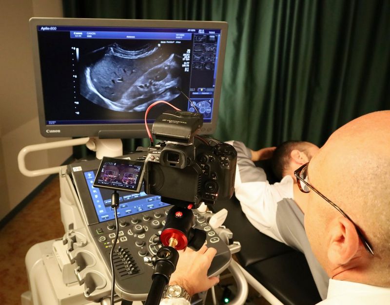 EOS R5 C RF 5.2mm F2.8L DUAL FISHEYE Canon Medical Systems, пример внедрения 02