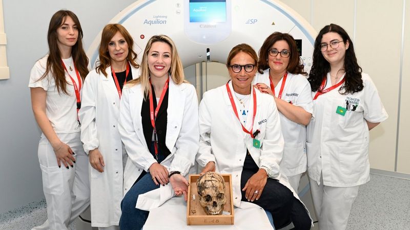 Sei scienziate in camice bianco con cordini rossi Canon davanti a uno scanner Canon Medical Aquilion Lightning SP. Di fronte a loro, un antico cranio in una scatola di legno.