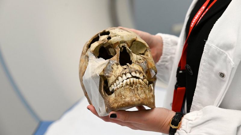 Arms and torso of a person in a white lab coat, carefully holding a very old human skull.