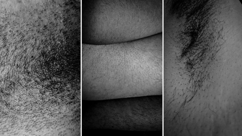 A triptych of images depicting hair on different, unidentifiable parts of the body.