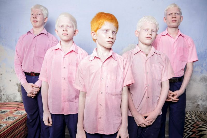 "Als fotograaf is mijn zicht mijn bron van inkomsten"