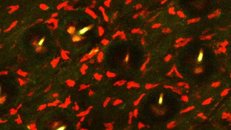 Microscopy showing scattered red clusters on a dark green background, with five dark circular pits each containing a single yellow-green glowing sliver. To the untrained eye, this could look like candlelight on a bed of flower petals.