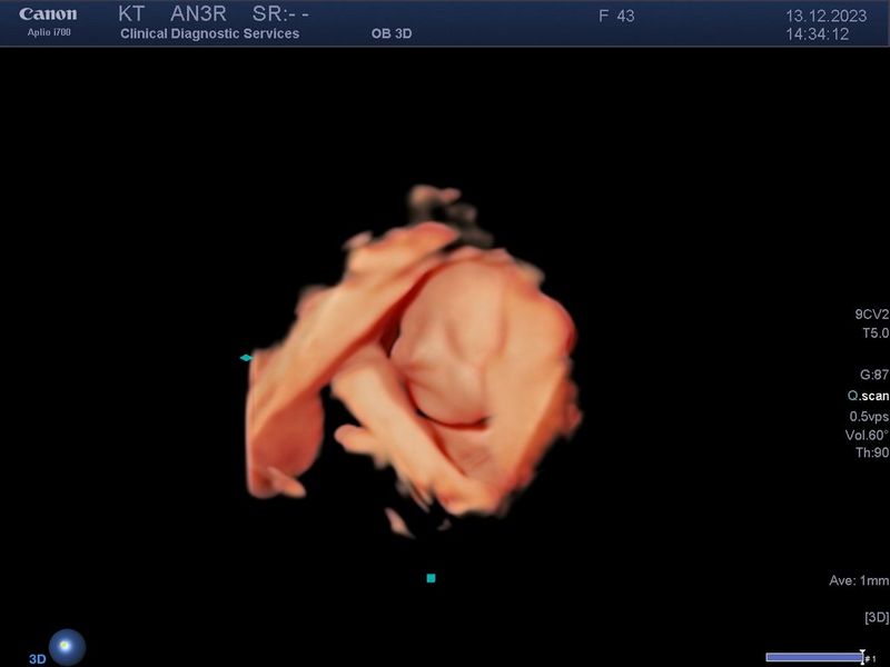 Karen Trippass baby scan image