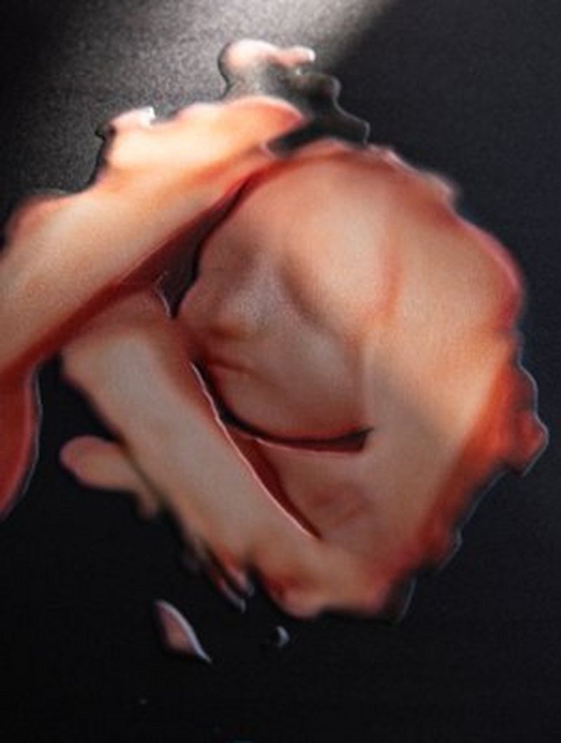 Close up of Karen Trippass baby scan image