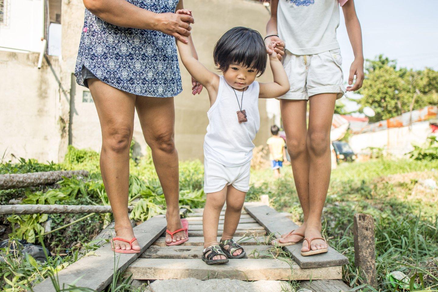 Un bébé portant un plâtre recevant un traitement de MiracleFeet et un jeune enfant souriant ont également reçu un traitement.