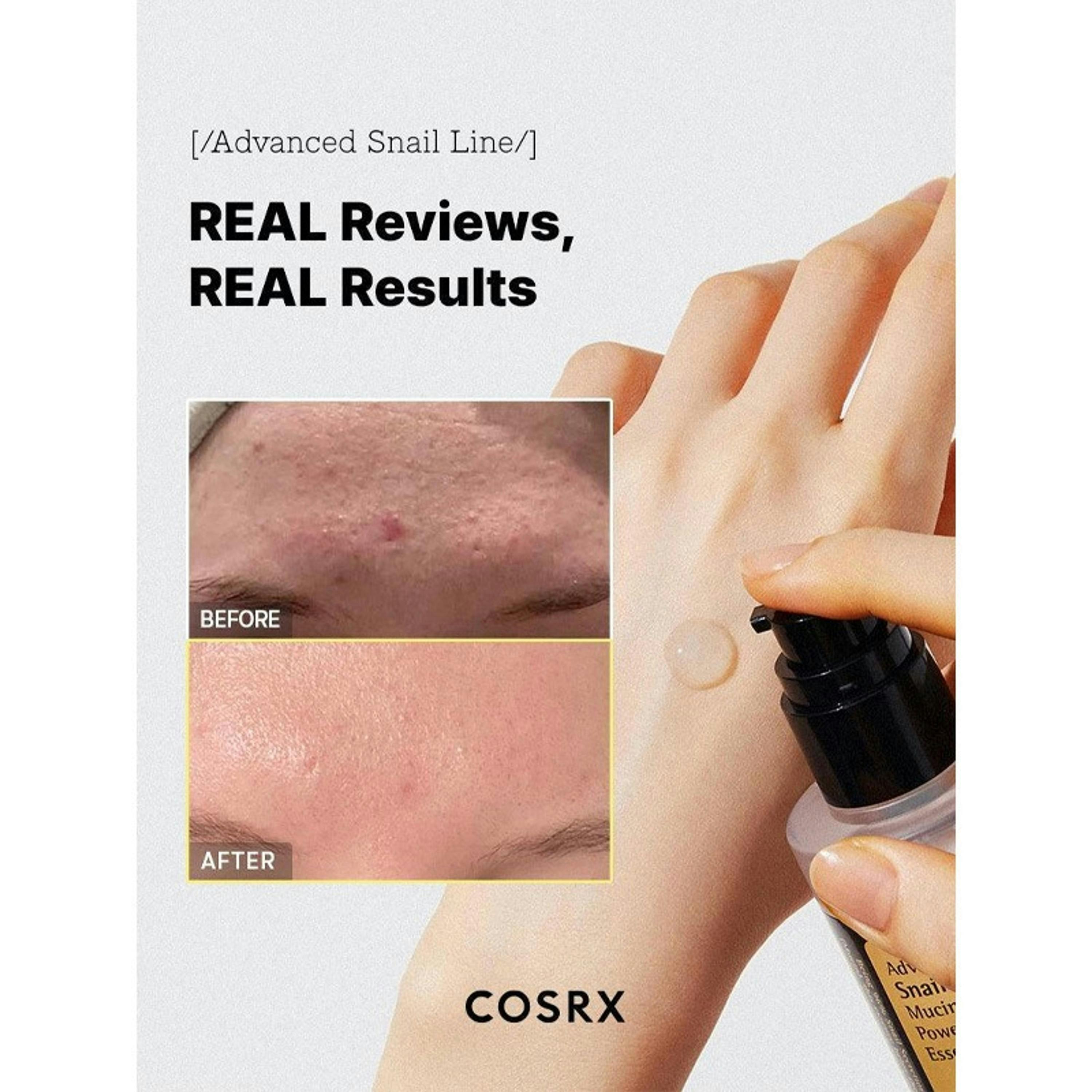 COSRX Advanced Snail 96 Mucin Power Essence 100 ml Single , view 2 of 5