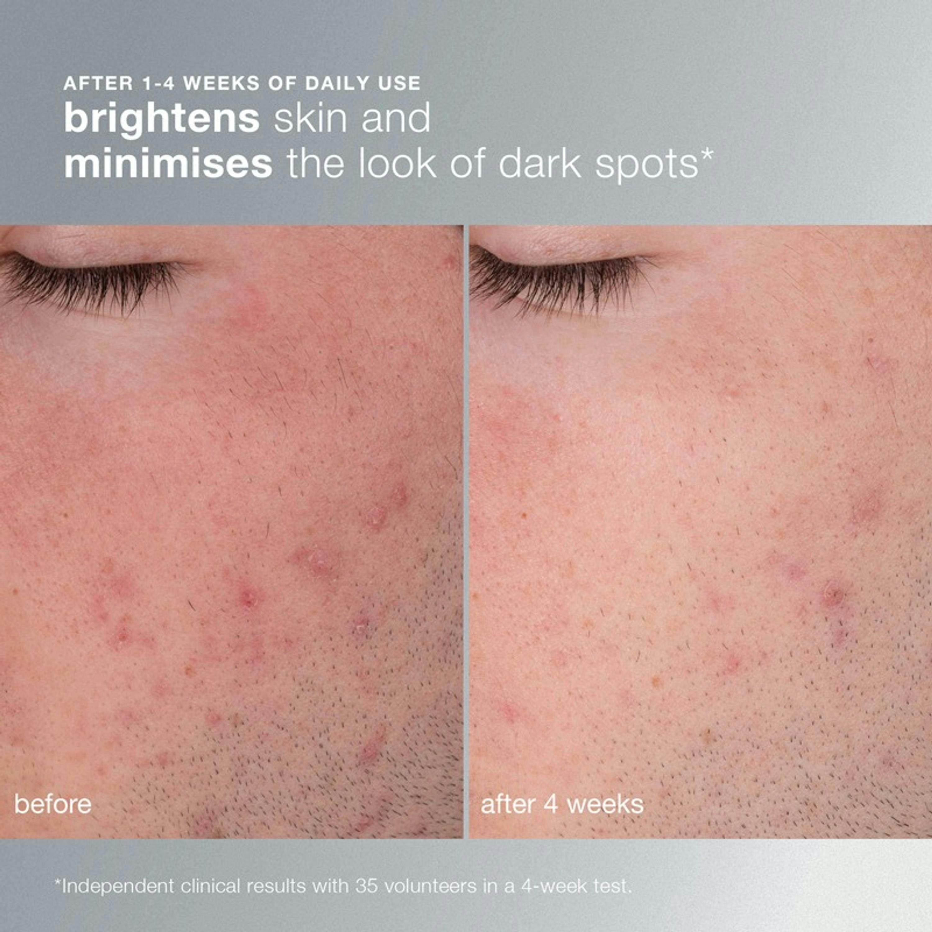 Dermalogica Daily Microfoliant Exfoliator 13 g Single , view 5 of 6