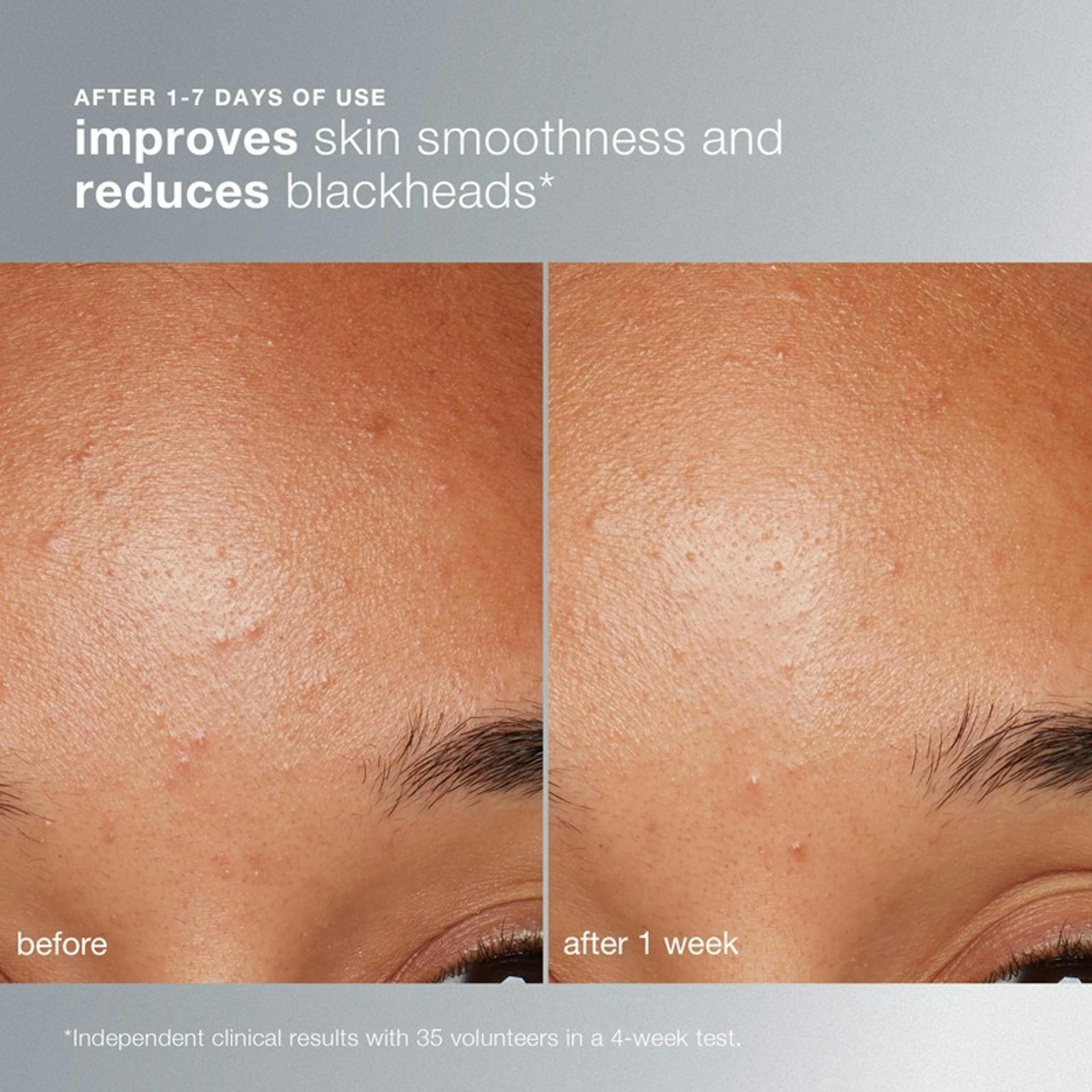 Dermalogica Daily Microfoliant Exfoliator 13 g Single , view 6 of 6