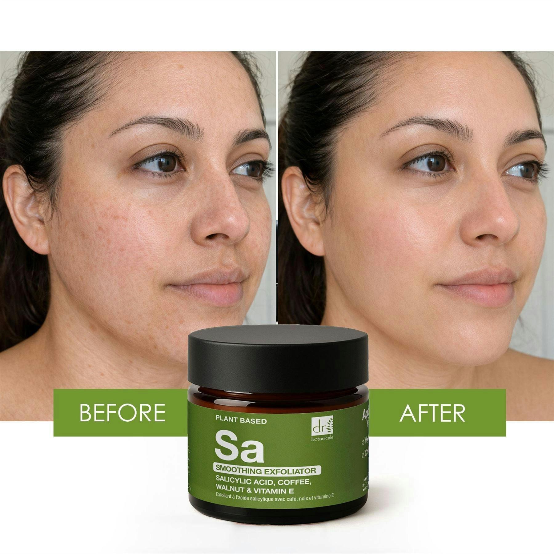 Dr. Botanicals Smoothing Exfoliator with Salicylic Acid with Coffee, Walnut & Vitamin E 60ml , view 2 of 6