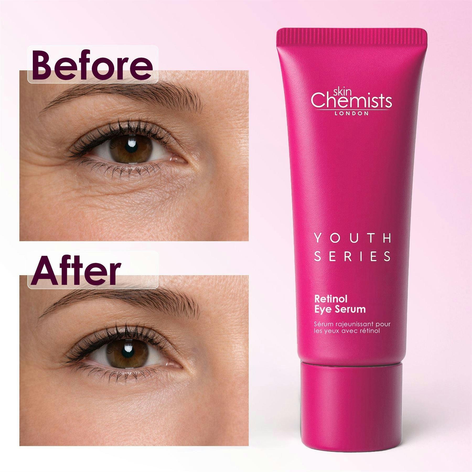 skinChemists Retinol Anti-Ageing Eye Serum 15ml , view 3 of 6