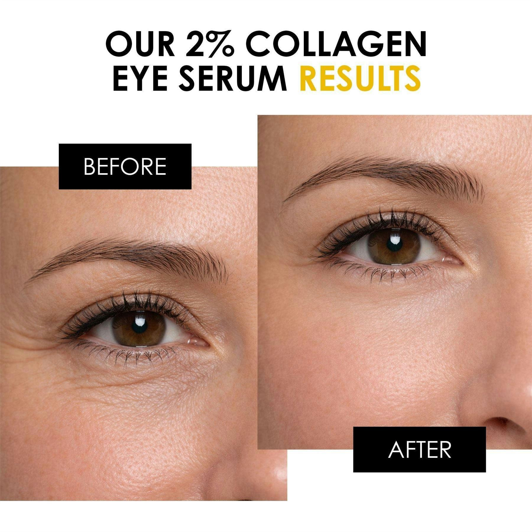 skinChemists 2% Collagen Anti-Ageing Eye Serum 15ml , view 2 of 6
