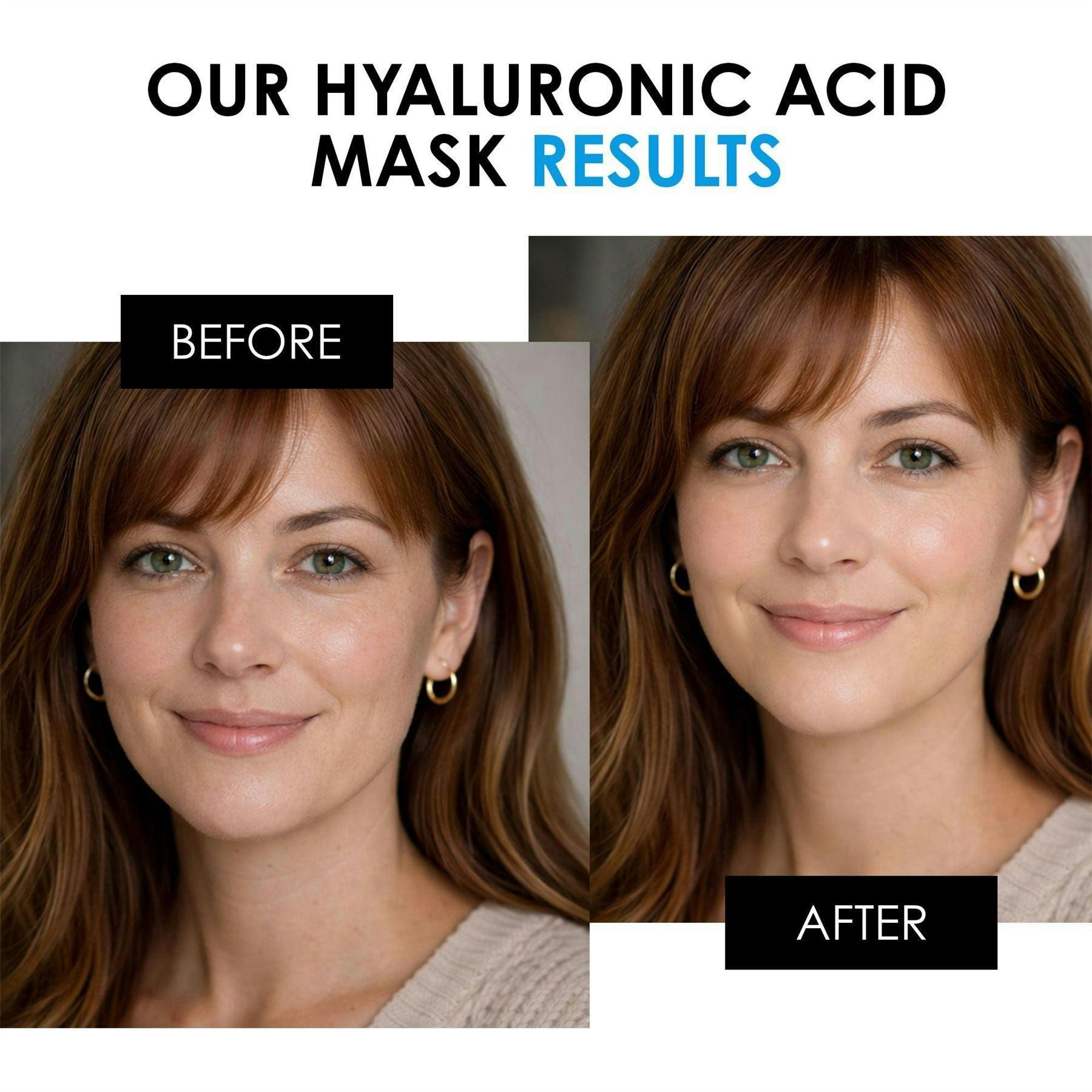 skinChemists Anti-Ageing Hyaluronic Acid Mask 50ml , view 3 of 6