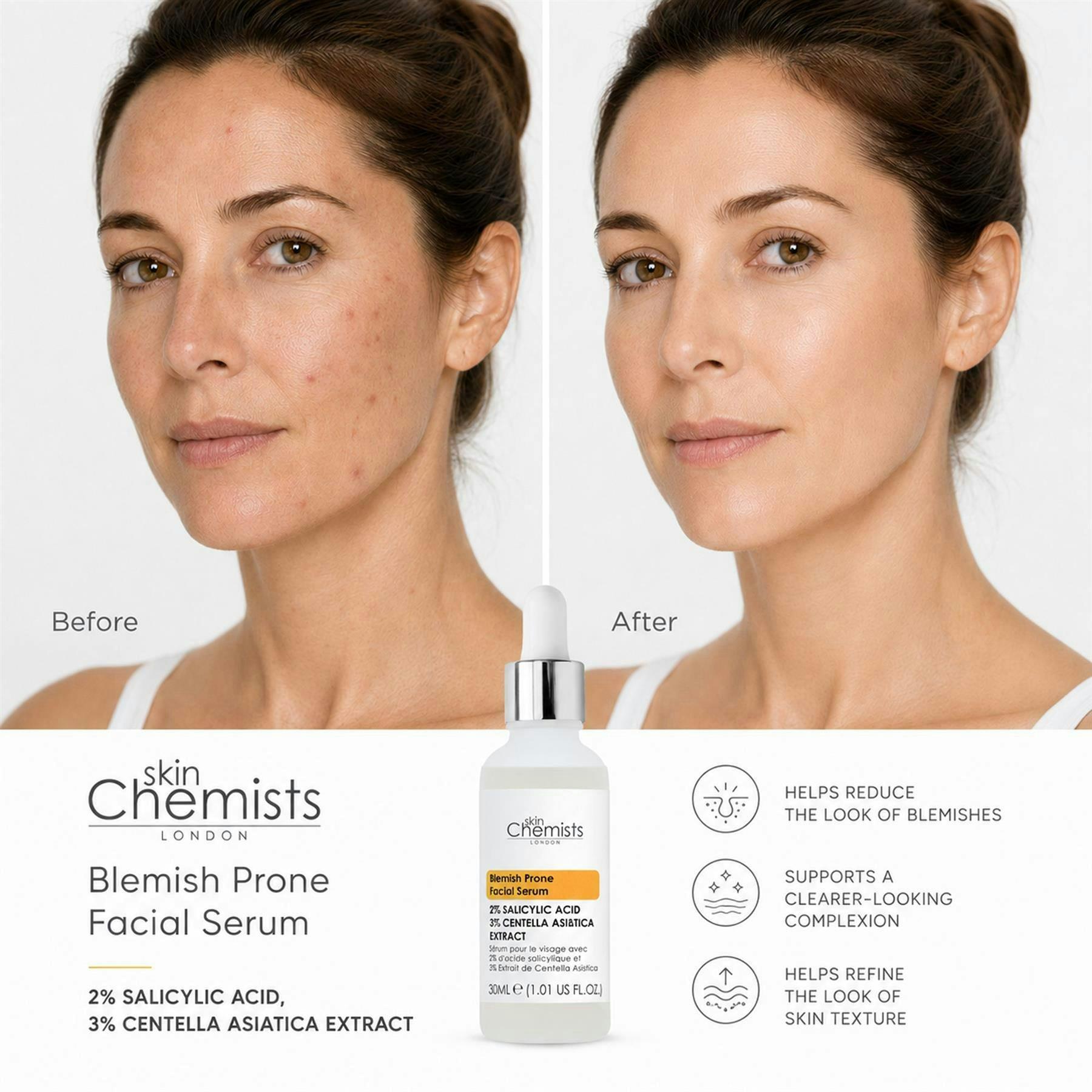 skinChemists Blemish Prone 2% Salicylic Acid, 3% Centella Asiatica Facial Serum 30ml , view 2 of 6
