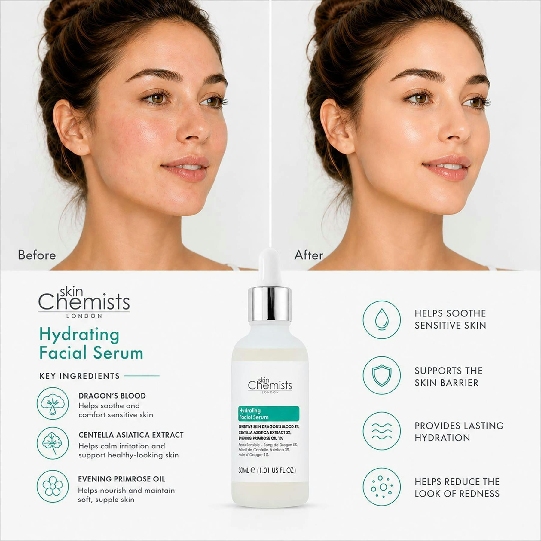 skinChemists Sensitive Skin 5% Dragon's Blood, 3% Centella Asiatica Facial Serum 30ml , view 2 of 6