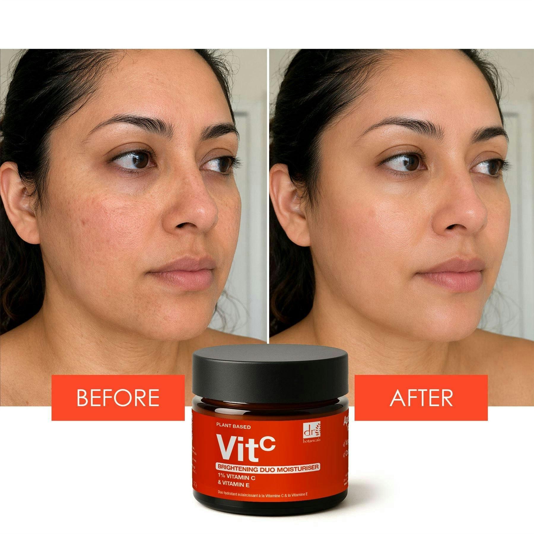 Dr. Botanicals Brightening Duo Anti-Ageing Moisturiser with 1% Vitamin C & Vitamin E 60ml , view 3 of 6