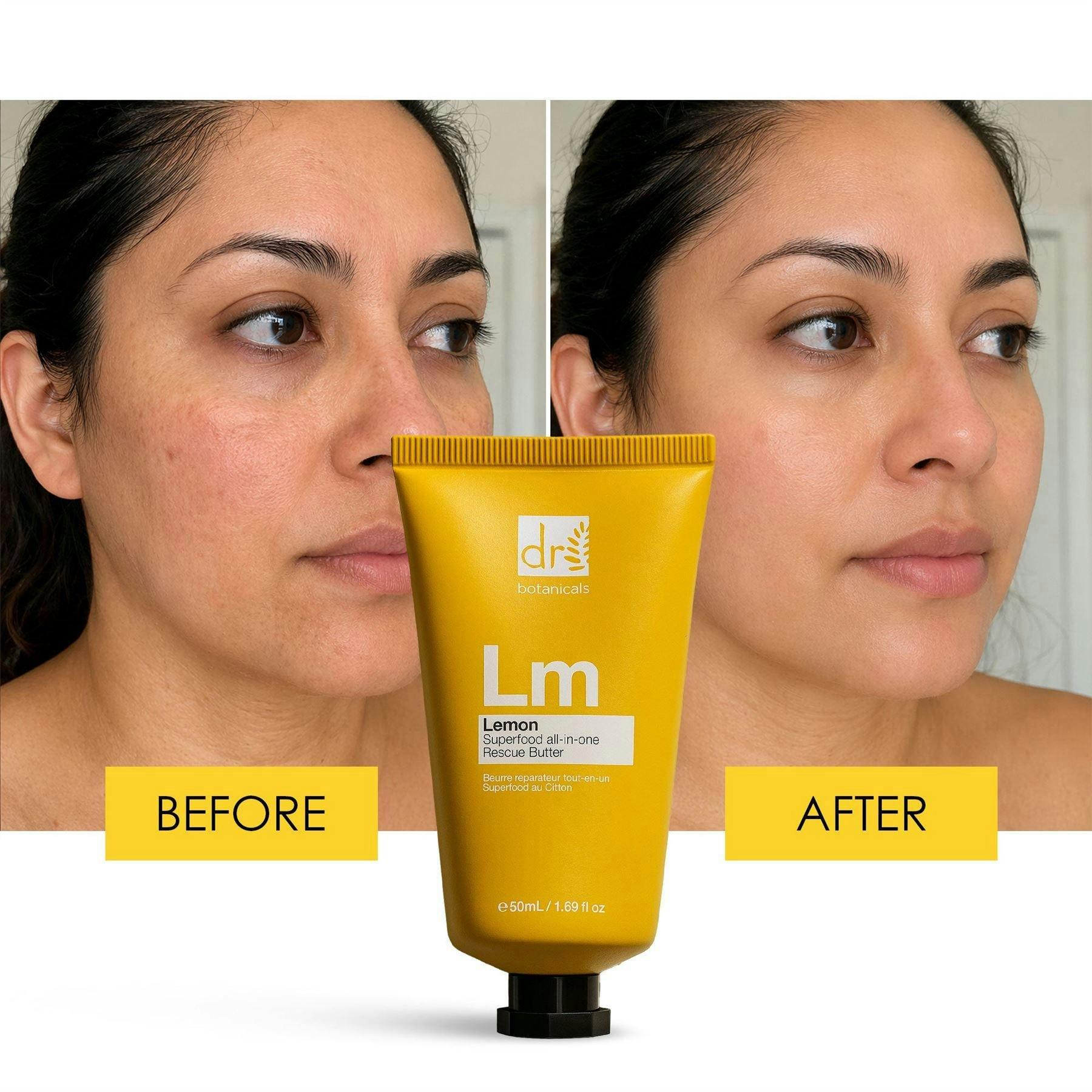 Dr. Botanicals Lemon Superfood Anti-Ageing All-In-One Rescue Butter 50ml , view 3 of 6