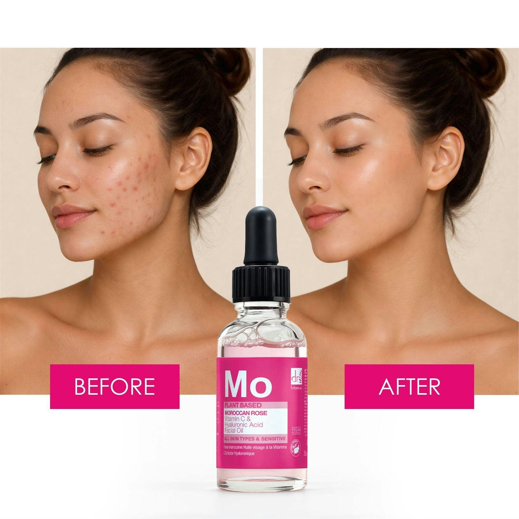 Dr. Botanicals Moroccan Rose Anti-Ageing Facial Oil with Hyaluronic Acid & Vitamin C 30ml , view 3 of 6