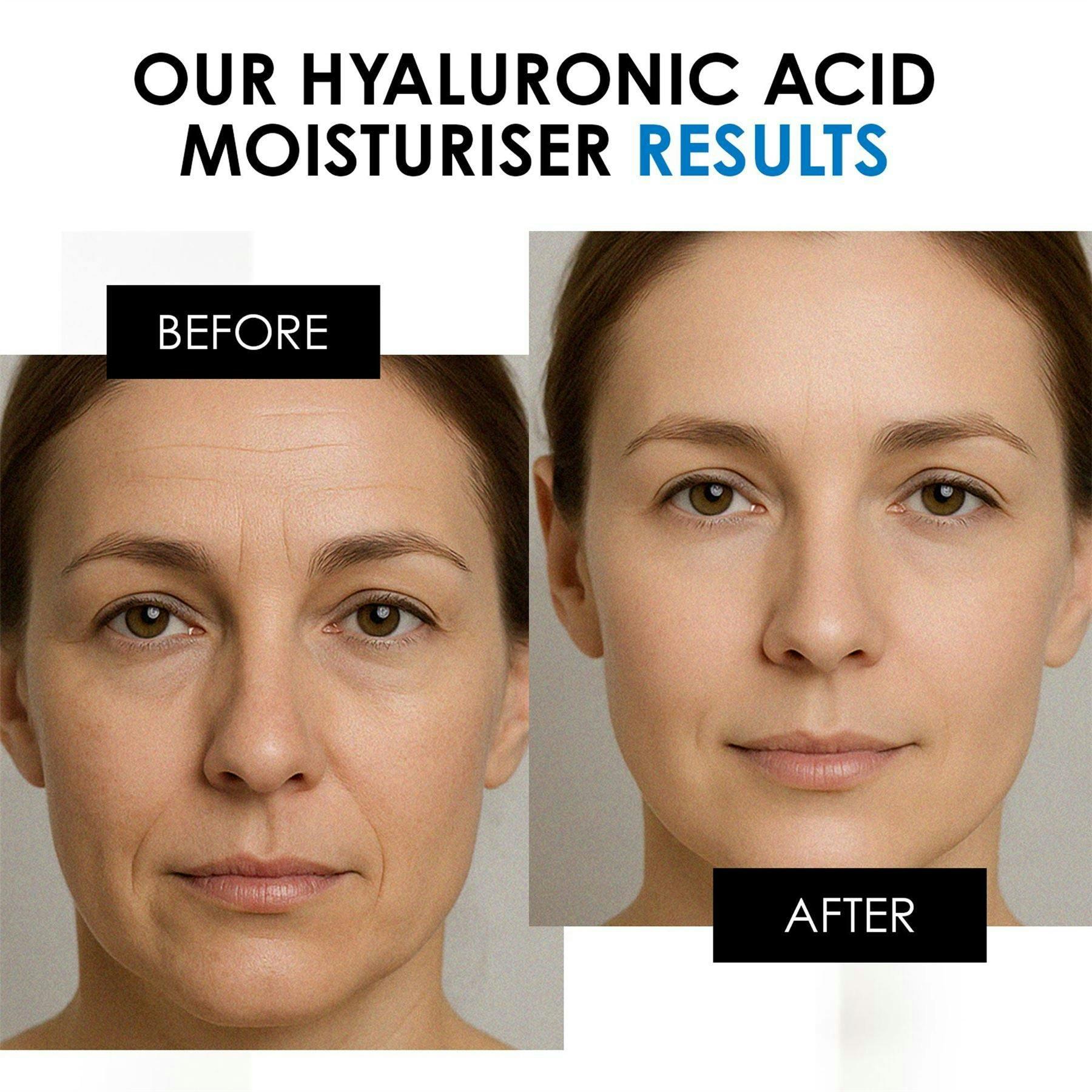 skinChemists Anti-Ageing Hyaluronic Hydration Treatment , view 4 of 6