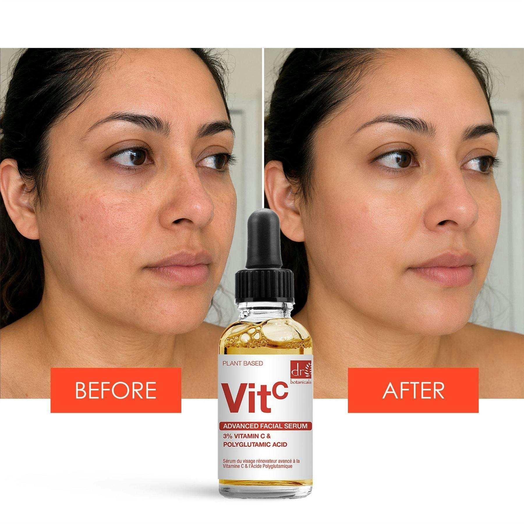 Dr. Botanicals Anti-Ageing Vitamin C Hydrating And Glow Treatment , view 4 of 6