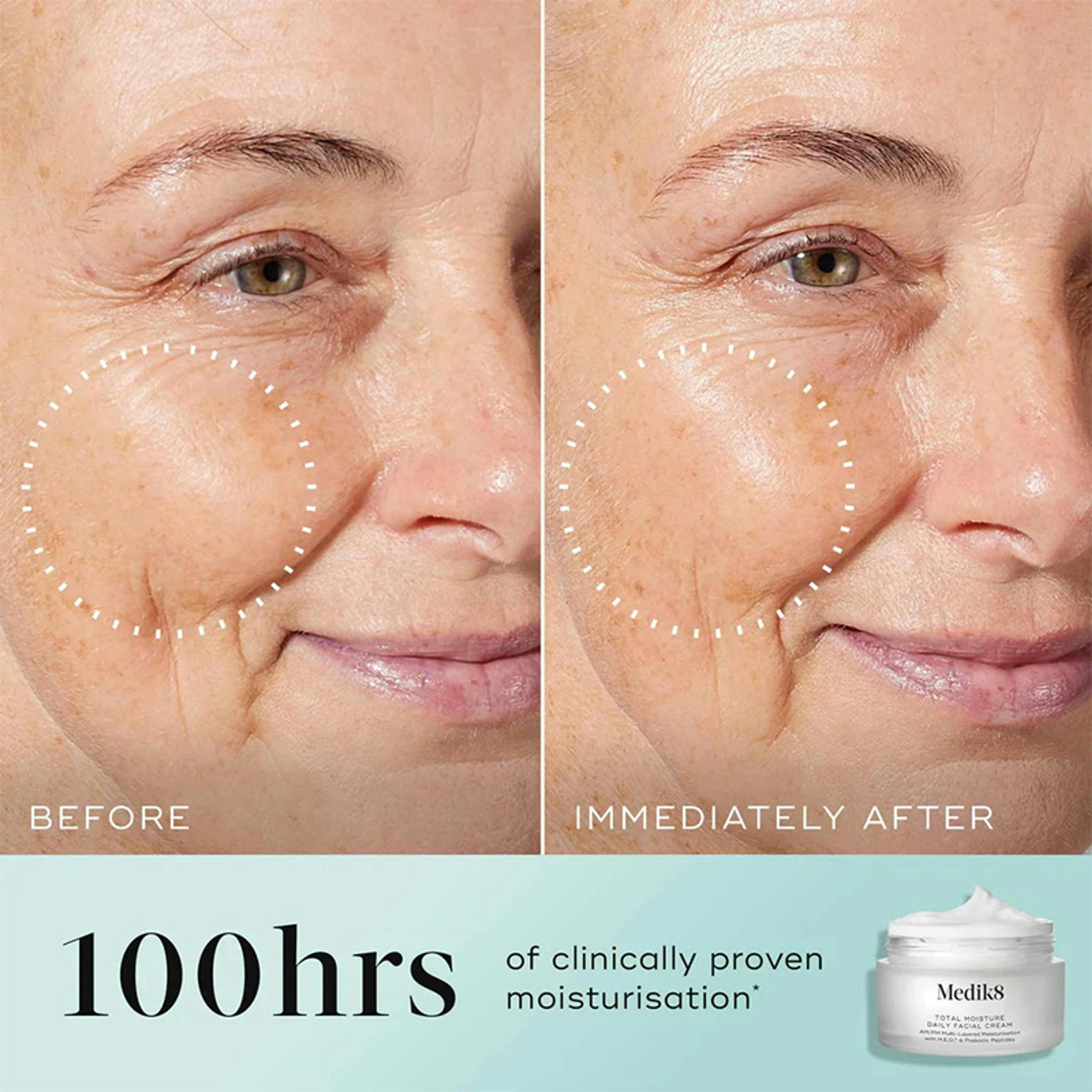 Medik8 Total Moisture Cream 50 ml Single , view 5 of 6