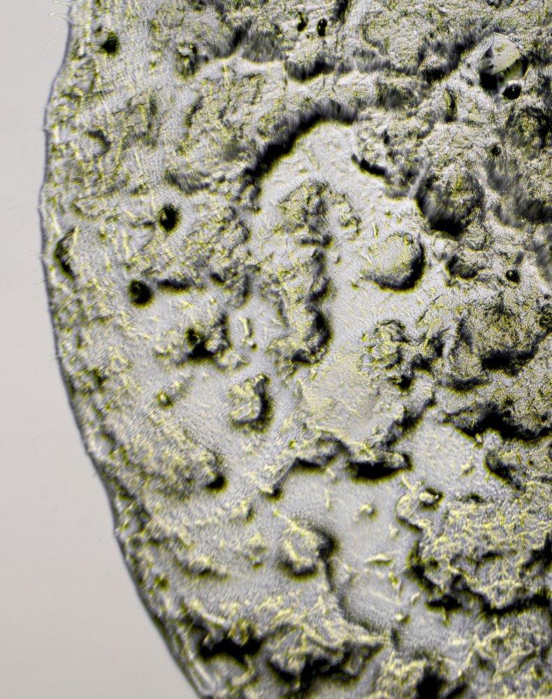 Niod Multi-Molecular Hyaluronic Complex (MMHC2)