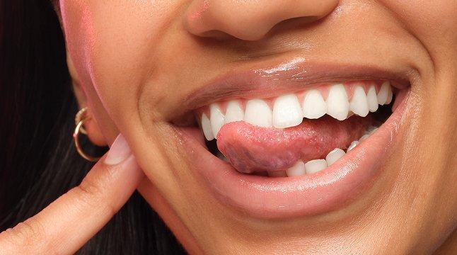 The Ord Dry and Flaky Lips