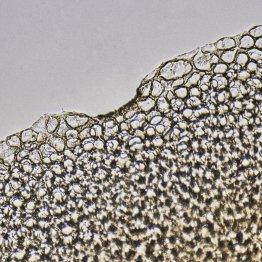 NIOD serum under a microscope