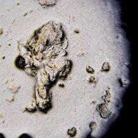 NIOD Transepidermal Water Loss (TEWL)