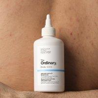 The ORD Sulfur 10 Treatment