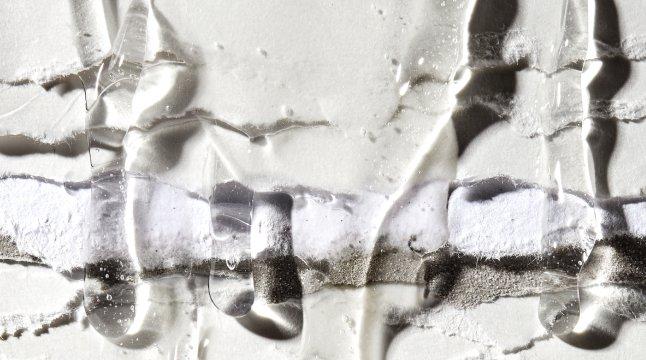 THE ORDINARY Common Causes of Breakouts on Skin.