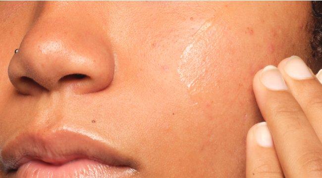 Person applying GF 15% Solution on face