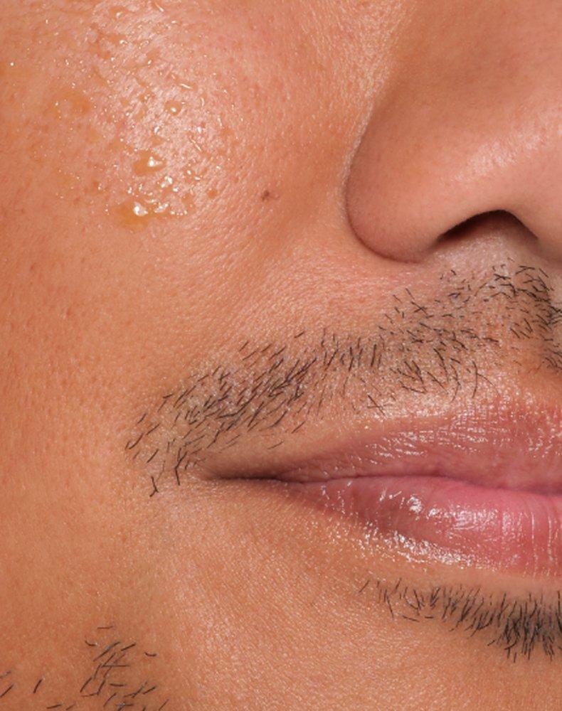 THE ORDINARY Argireline Solution 10%