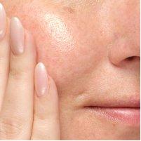 Soothing & Barrier Support Serum