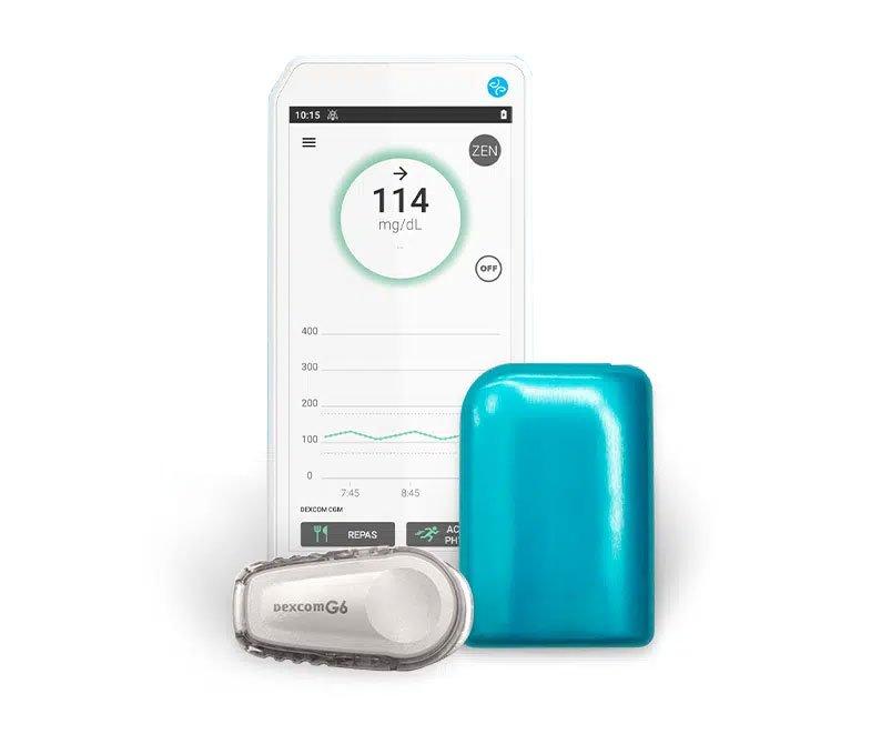 Kaleido en Dexcom G6