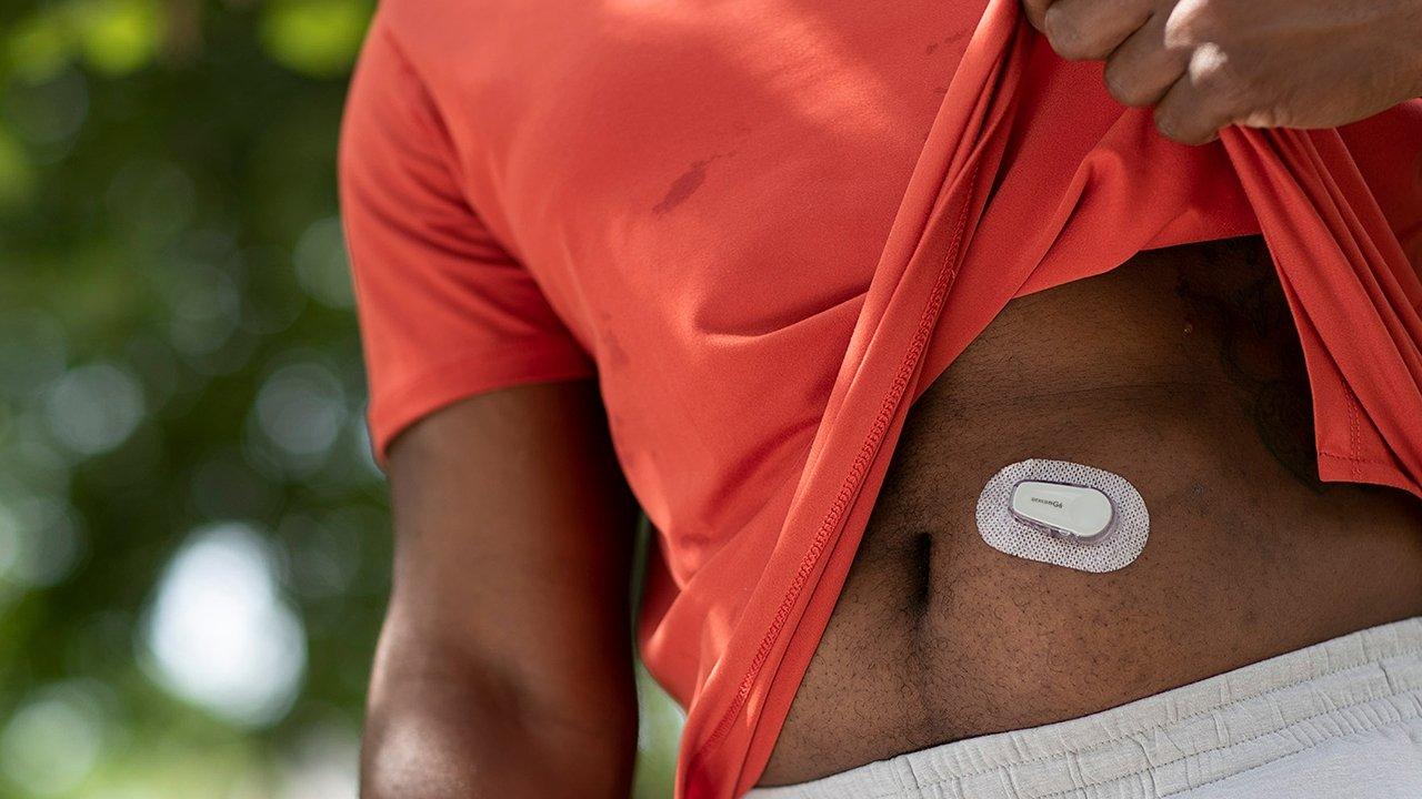 Advantages of Dexcom integrated CGM with insulin pumps
