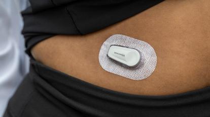 Dexcom G6 Placement: Best Spots On Your Body To Wear It, 59% OFF