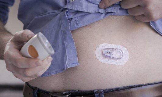 Osoba koja drži Dexcom jedan aplikator i senzor na trbuhu