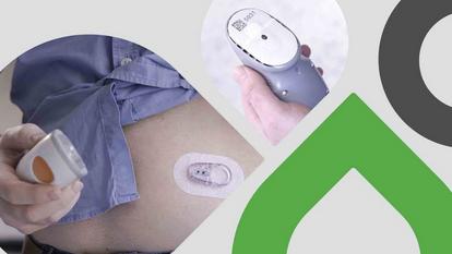 People using Dexcom products - Video thumbnail