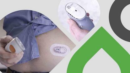 Man attaching Dexcom device to his belly - Video thumbnail