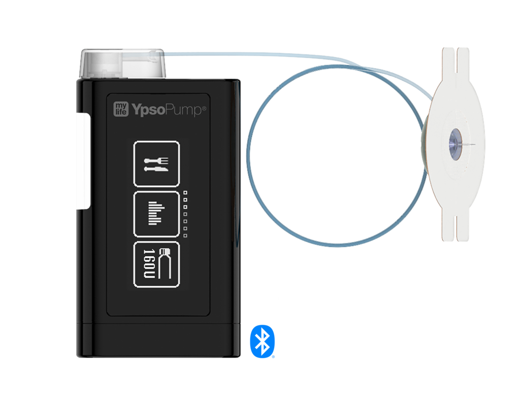 YpsoPump and Dexcom G6