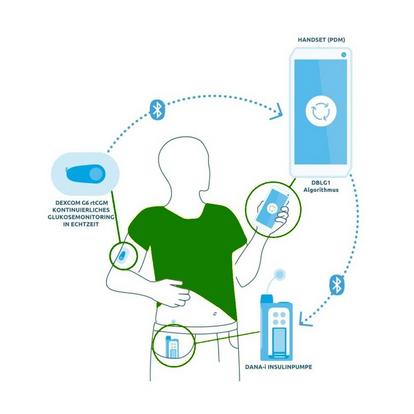 Ein Closed-Loop-System, passend zu deinem Lebensstil