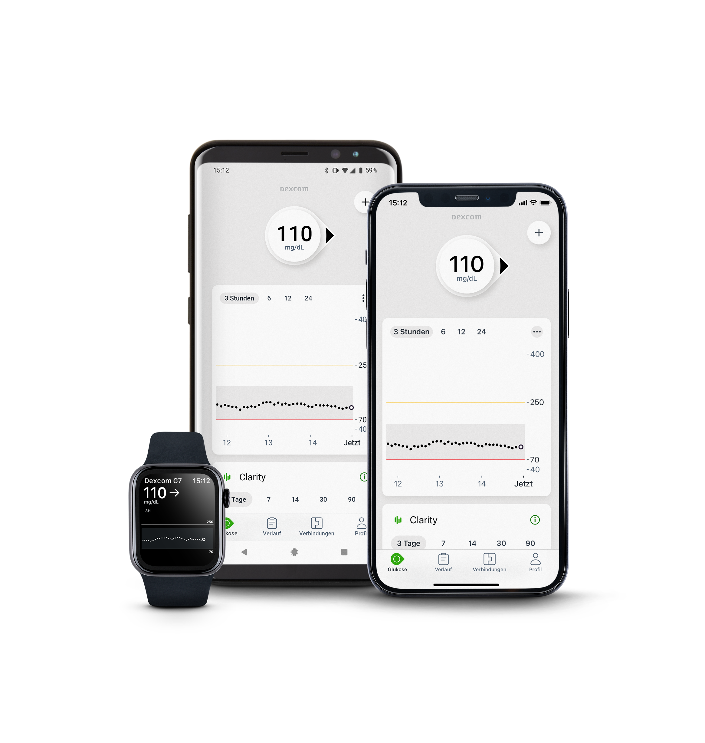 Zusammengesetztes Bild von Smartwatch und Smartphones mit der Dexcom-App auf dem Bildschirm
