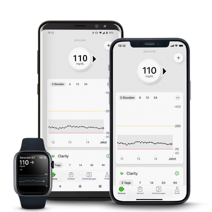 Zusammengesetztes Bild von Smartwatch und Smartphones mit der Dexcom-App auf dem Bildschirm