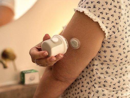Du bringst den Dexcom Flex Sensor einfach am Oberarm an – schnell und ohne Fingerstechen