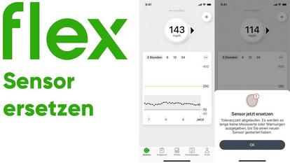 Deinen Dexcom Flex Sensor ersetzen