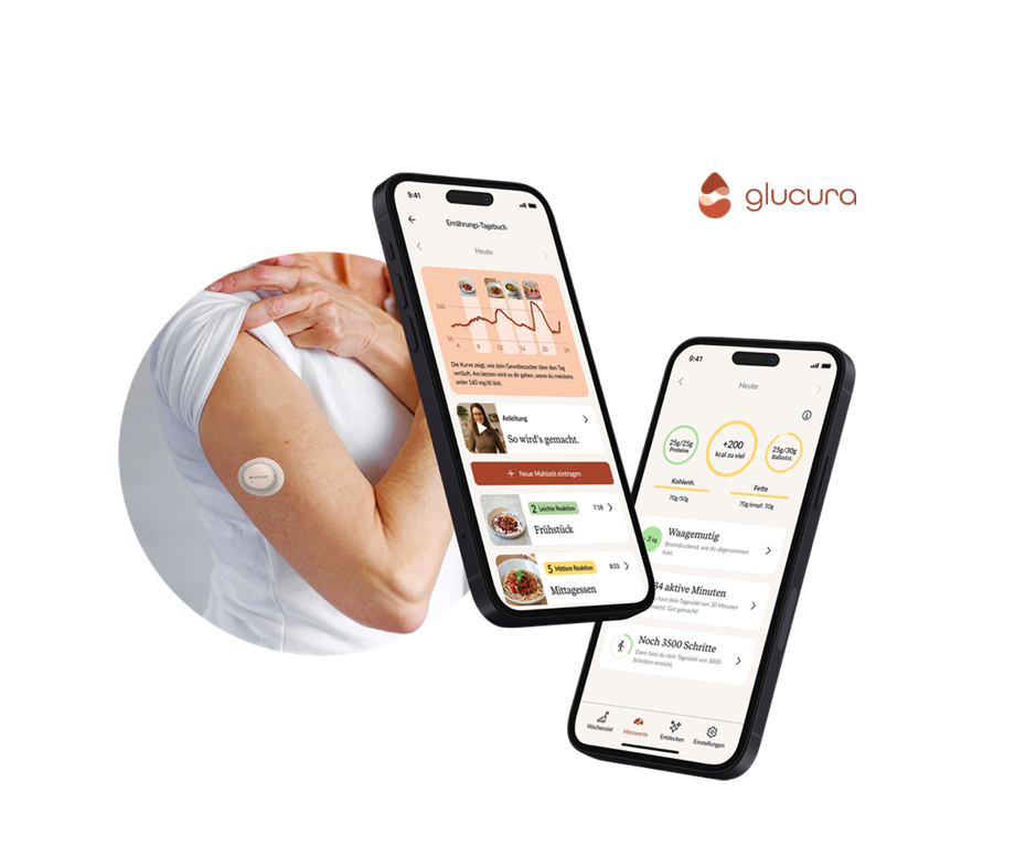 an upper arm showing dexcom G7 that will show your sugar levels at a glance with a smartphone floating next to it and showing the AI-powered health app glucura you can get on prescription in Germany.